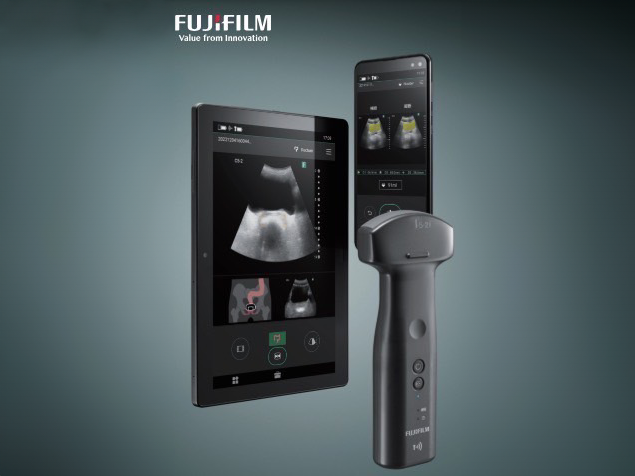 超音波検査(エコー)